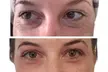 Sacred Womb and Body Renewal, Sacred Renewal Face & Neck Tighten, or Fibroblast for Crows Feet - Second Medium