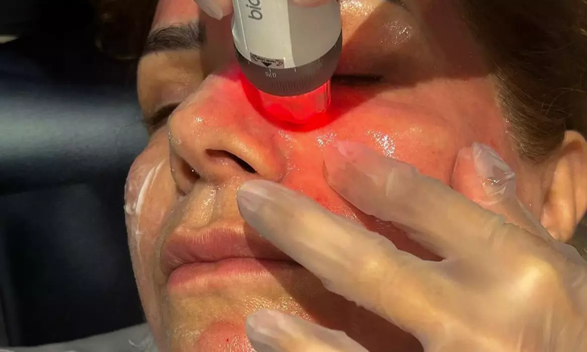 One or Two Sessions Of Profhilo® OR Seventy Hyal With Consultation at Diyah Aesthetics - Up to 57% Off - Primary Image