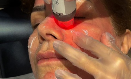 One Session Of Profhilo® OR Seventy Hyal  With Consultation - Diyah Aesthetics