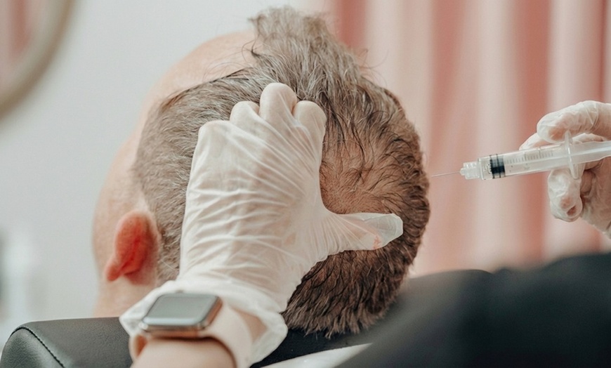 Image 2: Discover Fuller Hair: One or Three Laser Hair Restoration Sessions