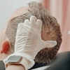 Image 2: Discover Fuller Hair: One or Three Laser Hair Restoration Sessions