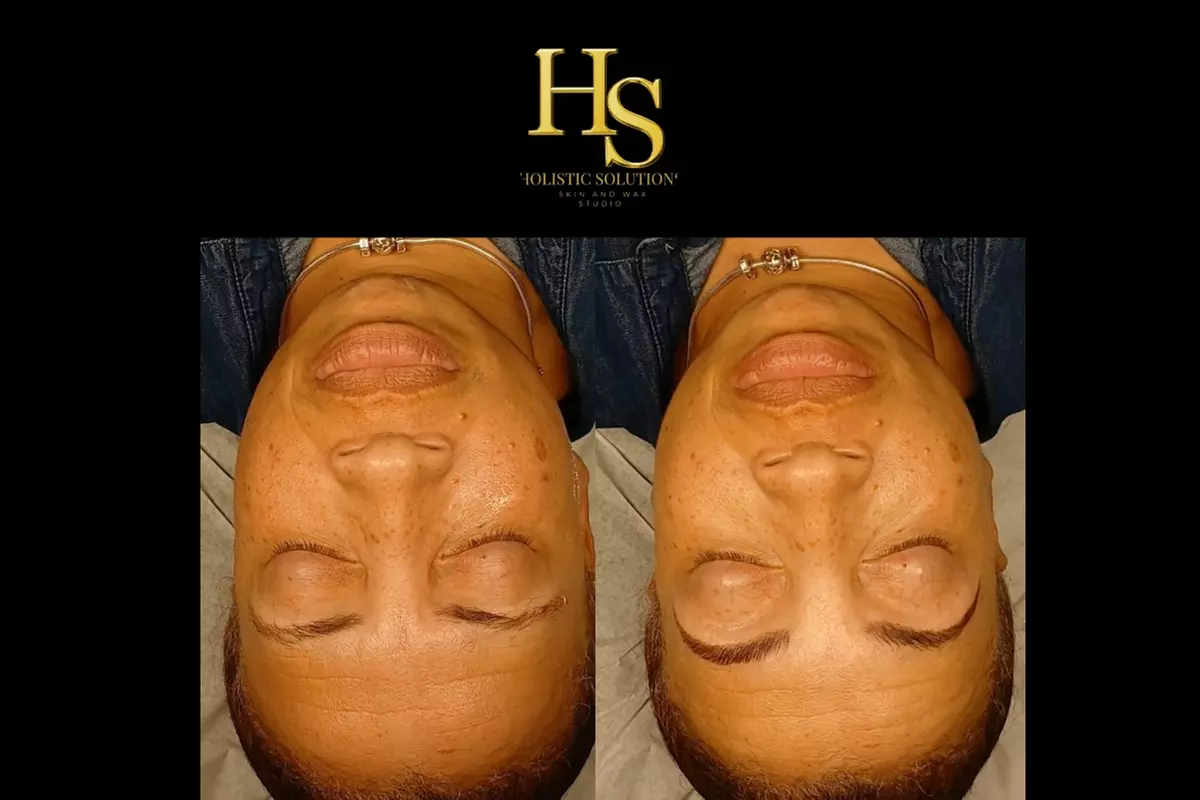 30 Minute Leg & Foot, Scalp or Upper Body Massage w/ Hot Towels & More