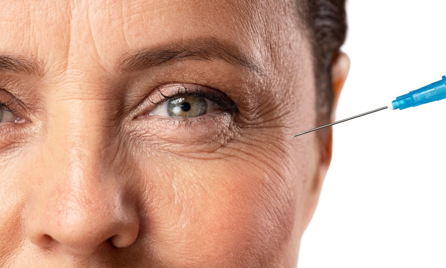 Image 2: PRP & PRF EZ Gel Injections for Face, Under-Eyes & Hair Restoration