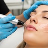 Image 1: Up to 59% Off on Micro-Needling at The Caci Clinic