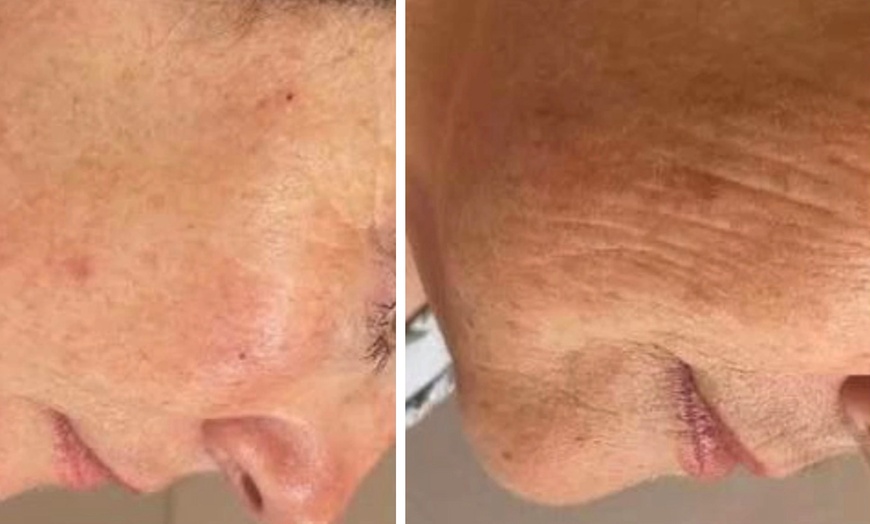 Image 5: Hydra Facial, Lumi Eyes, or Lumi Pro for a Radiant Glow!