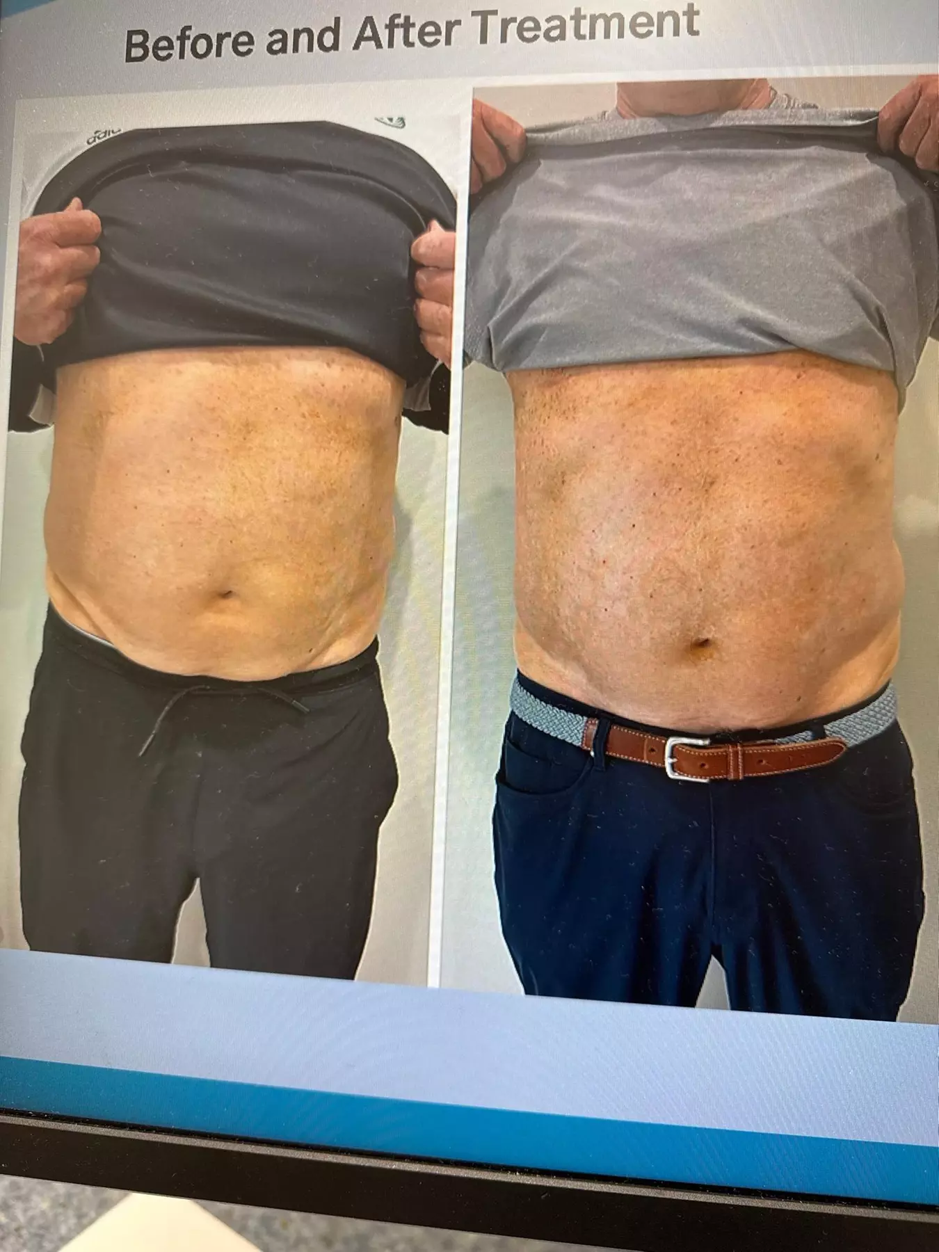 30-Minute T-Shape 2'' Massage w/ Optional Styku 3D Body Scan for 1 at Lifestyle Health Solutions (Up to 64% Off)