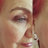 Image 3: 20, 40 Units of Botox or a Syringe of Juvederm Injections
