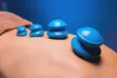 Discover bliss w/ ABC mobile acupuncture: Acupuncture Cupping Scraping Hot-towel compression/More(Up to 48% Off) - Second Medium