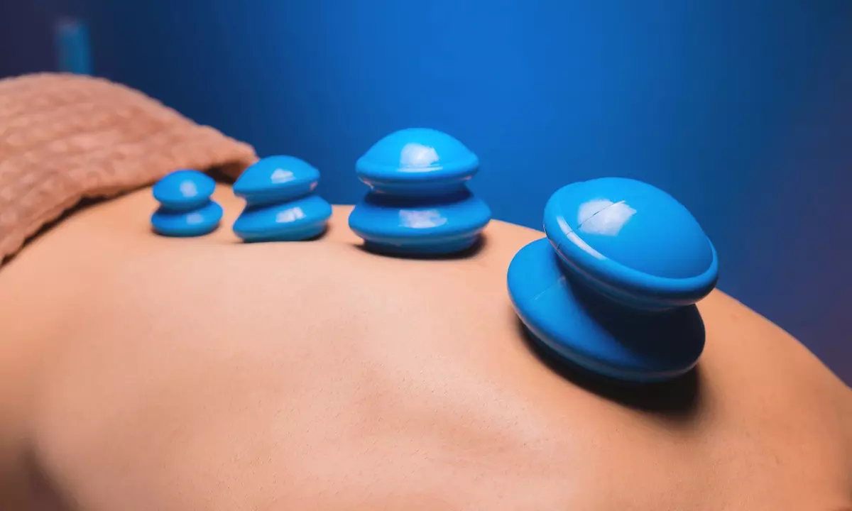 Acupuncture Cupping Scraping Hot-towel compression, Massage or More