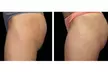 Get EMS Sculpt Abs/Buttocks/Thighs in Just 30 Minutes at Harmony In Health (Up to 74% Off) - Second Medium