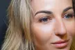 Enhance Your Lips with Lip Filler - Half or Full Syringe at Ora Wellness and Aesthetics (Up to 22% Off) - Second Medium