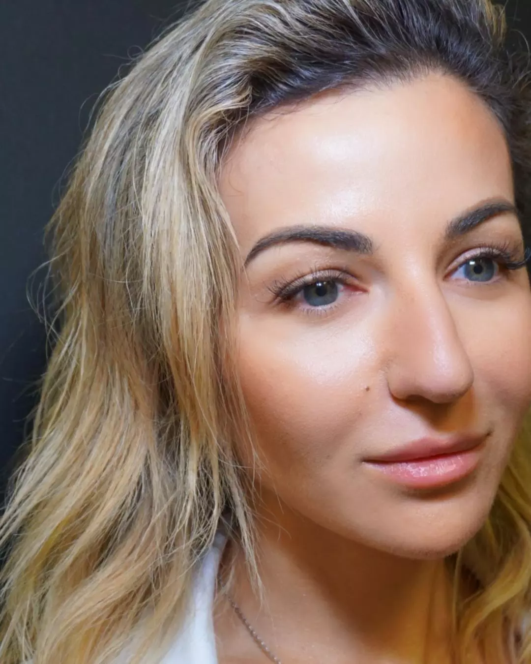 Enhance Your Lips with Lip Filler - Half or Full Syringe 