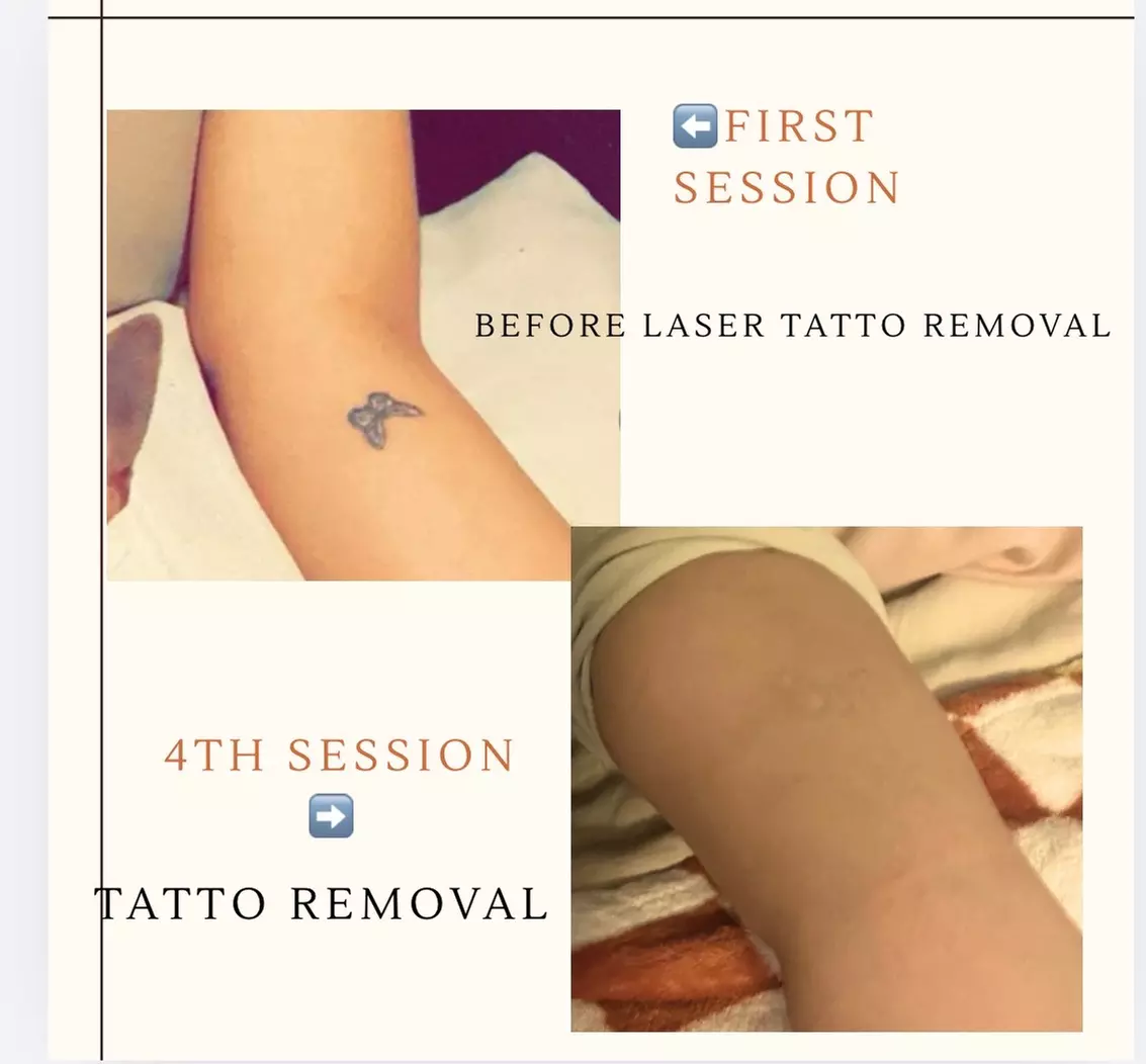 Microblading Sessions at Skinz.Beauty.Studio