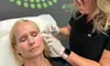 Achieve smoother skin with 50 units of Dysport, Xeomin or Jeuveau at 4Ever Young Miami—Save up to 29%