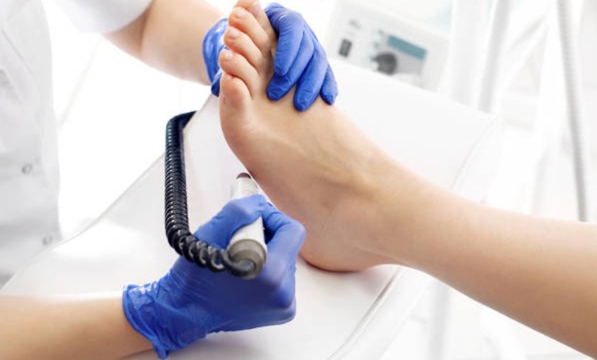 Image 6: 1 o 2 sesiones de quiropodia de 20-30 minutos para una persona