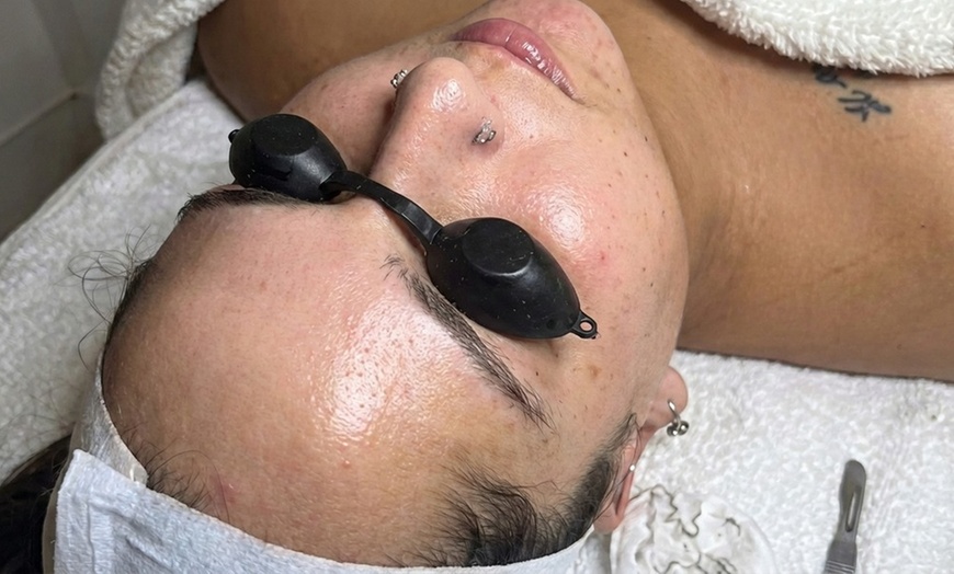 Image 2: 1, 2, or 3 Facials or Upgrade to Dermaplaning/Microdermabrasion