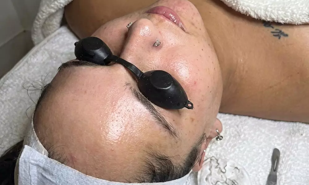 1, 2, or 3 Facials or Upgrade to Dermaplaning/Microdermabrasion