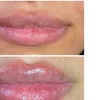 Image 9: Smooth, Plump & Perfect: Versa Enhancements at Divaa Beauty