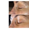 Image 2: Revitalize Tired Eyes: Opti Firm Eye Treatment