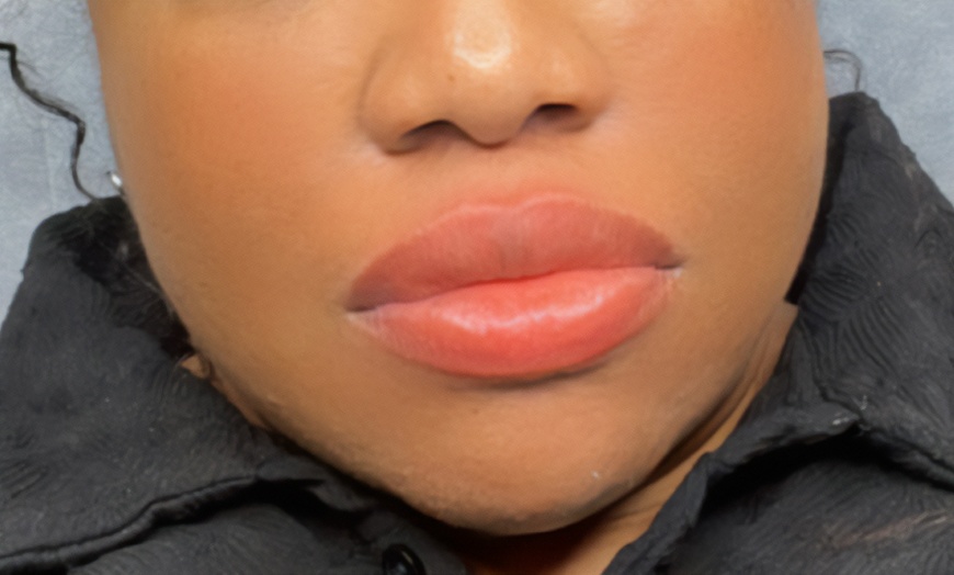 Image 2: Even-Toned Beauty: Dark Lip Neutralization & Optional Enhancement