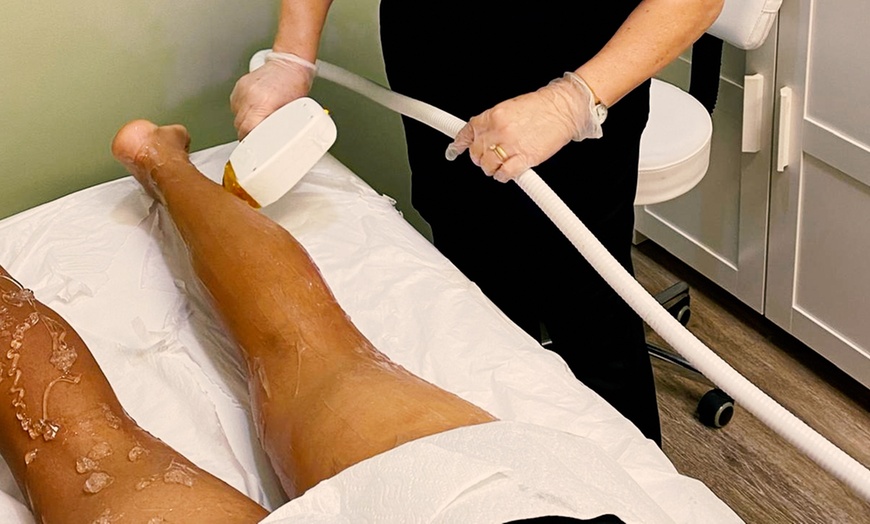 Image 2: Smooth Skin Deals: 30- & 60-Min Electrolysis Sessions