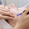 Image 1: Full Face Microneedling Treatment or Microneedling w/ PRP / Exosomes