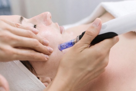 Micro-Needling Treatment With PRP / Exosomes - Brows and Botox MedSpa and Permanent Makeup