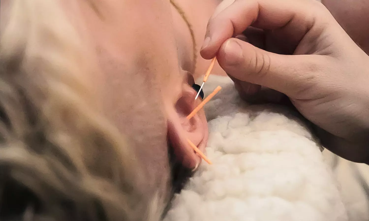 Experience Reiki with Acupuncture & Meditation