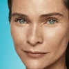 Image 2: Revitalize Skin's Youthful Glow with One Syringe of Radiesse Filler