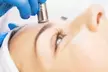DiamondGlow Facial or Microdermabrasion and Light Peel Combo Treatment with Spa Bella Medispa (Up to 51% Off) - Second Medium