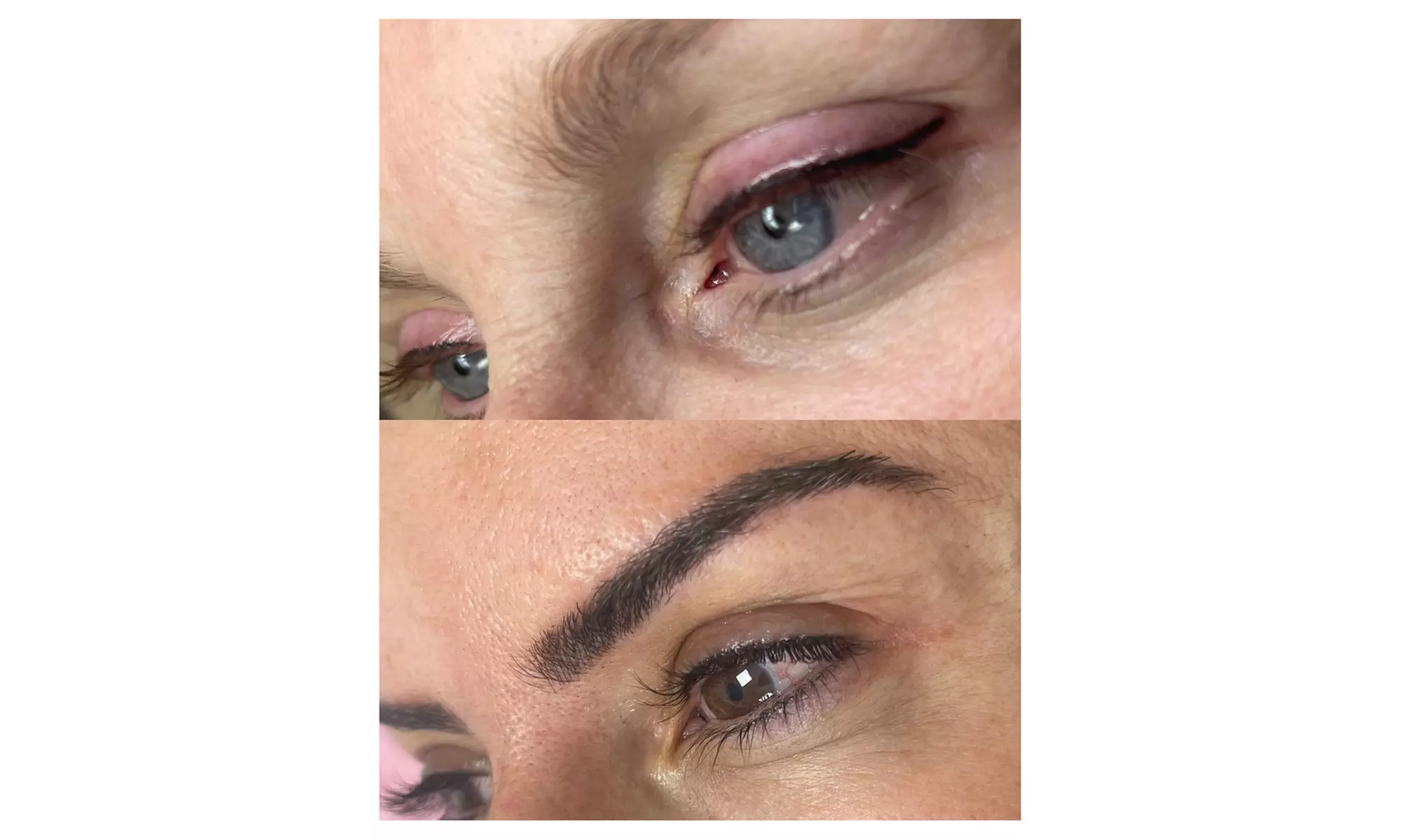 ¡Adiós, maquillaje! Sesión de micropigmentación de eyeliner o labios