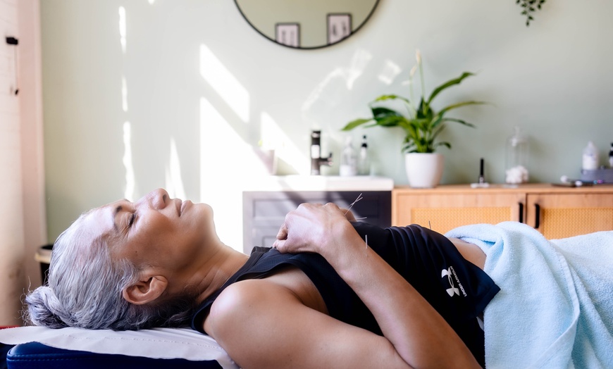 Image 1: Cupping with Deep Tissue Massage or Acupuncture in Shoreditch, London