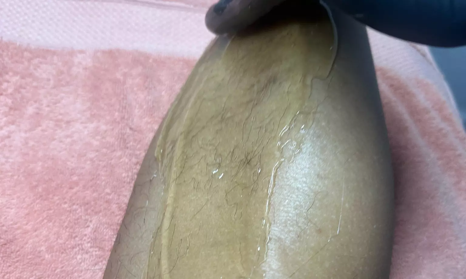 Get One or Two Brazilian Sugaring Treatments@ 58%