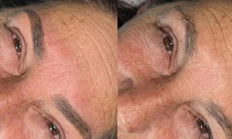 Micropigmentación de cejas o fusión con diseño previo