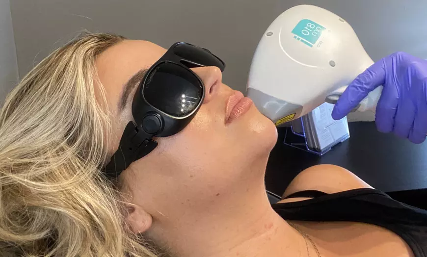 Image 10: Up to 89% Off on Laser Hair Removal at See You Laser
