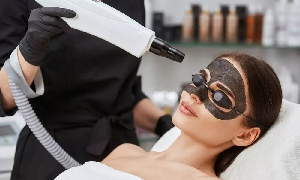 Luxury Carbon Facial – Black Beauty Glow for Radiant, Spotless Skin