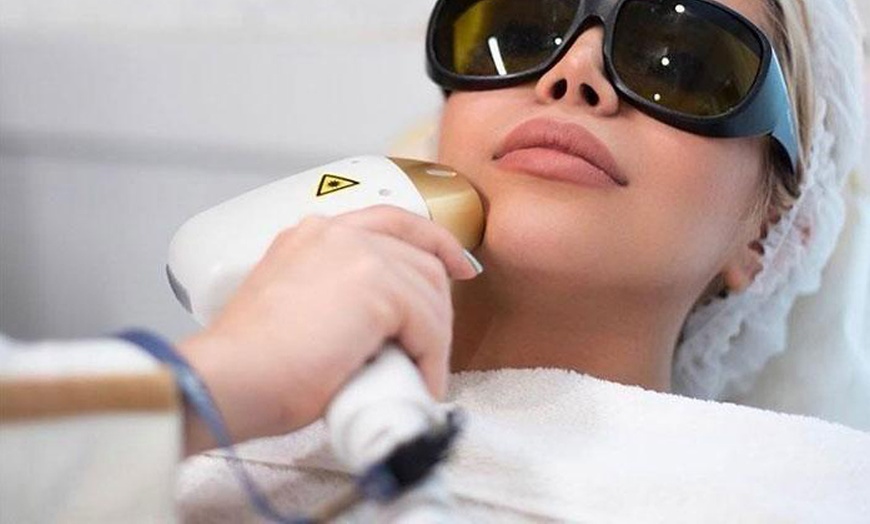 Image 1: 3 - 6 Behandlungen für eine Haarentfernung mit Diodenlaser