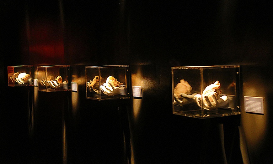 Image 4: REAL BODIES at Horseshoe Las Vegas – Discover the Human Body Like Never Before 