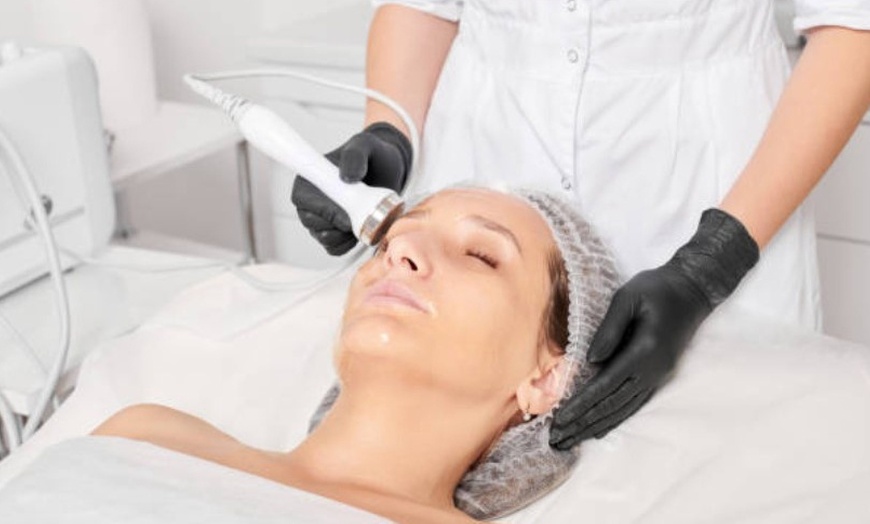 Image 5: Tratamiento HIFU 22D ultralifting en zona a elegir para 1 persona