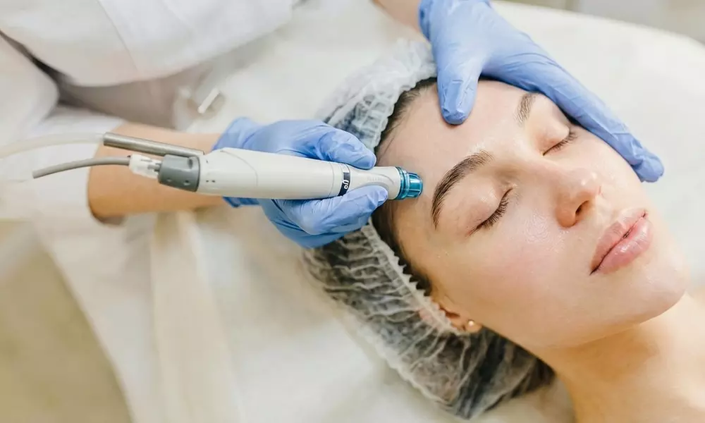 Limpieza facial en 6 pasos con microdermoabrasión y opción a LED