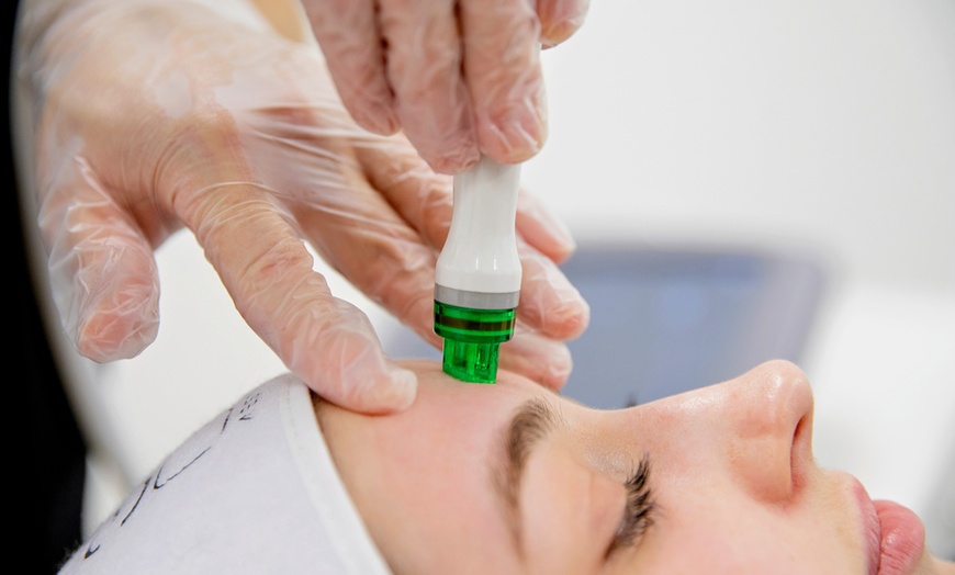 Image 2: HydraFacial with Optional Radio Frequency for Hydrated & Radiant Skin