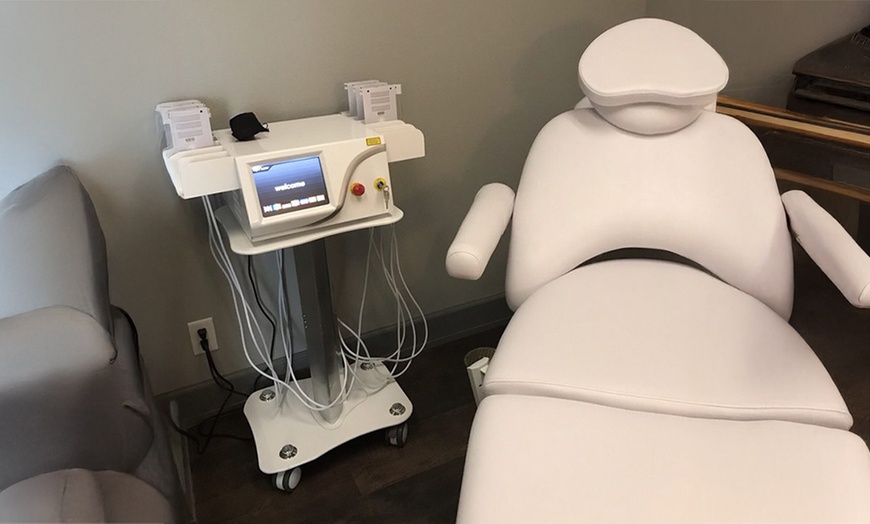 Image 3: Single Blast Lipo Laser for Body Sculpting