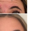 Image 2: 20, 40, or 60 Units of Letybo® Treatments for Smoother Skin