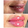Image 8: Smooth, Plump & Perfect: Versa Enhancements at Divaa Beauty