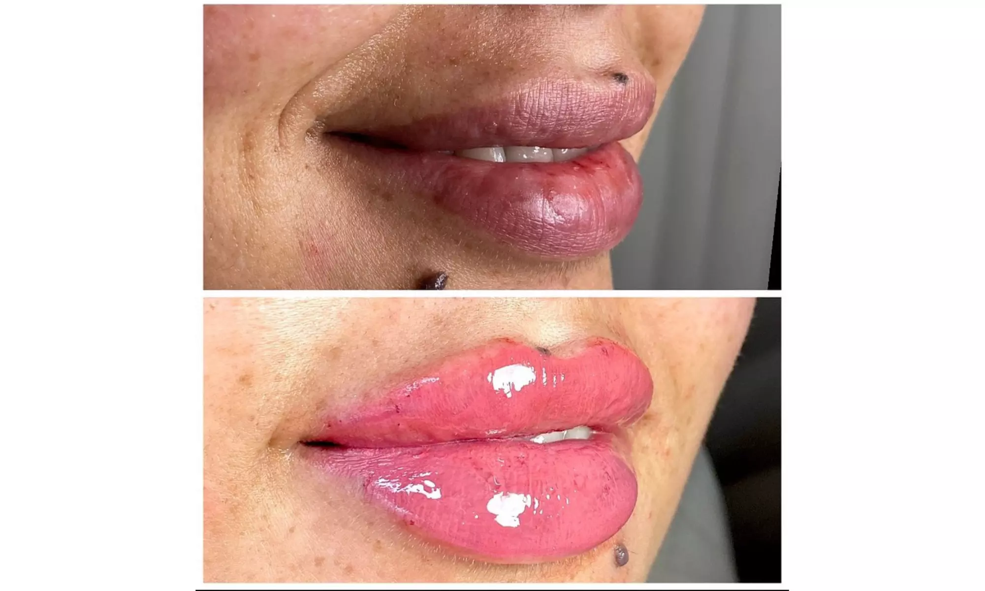 Smooth, Plump & Perfect: Versa Enhancements at Divaa Beauty