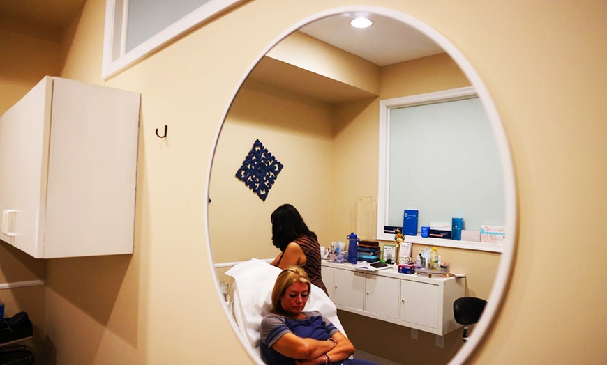 Image 6: Sculptra Treatments in Springfield, PA
