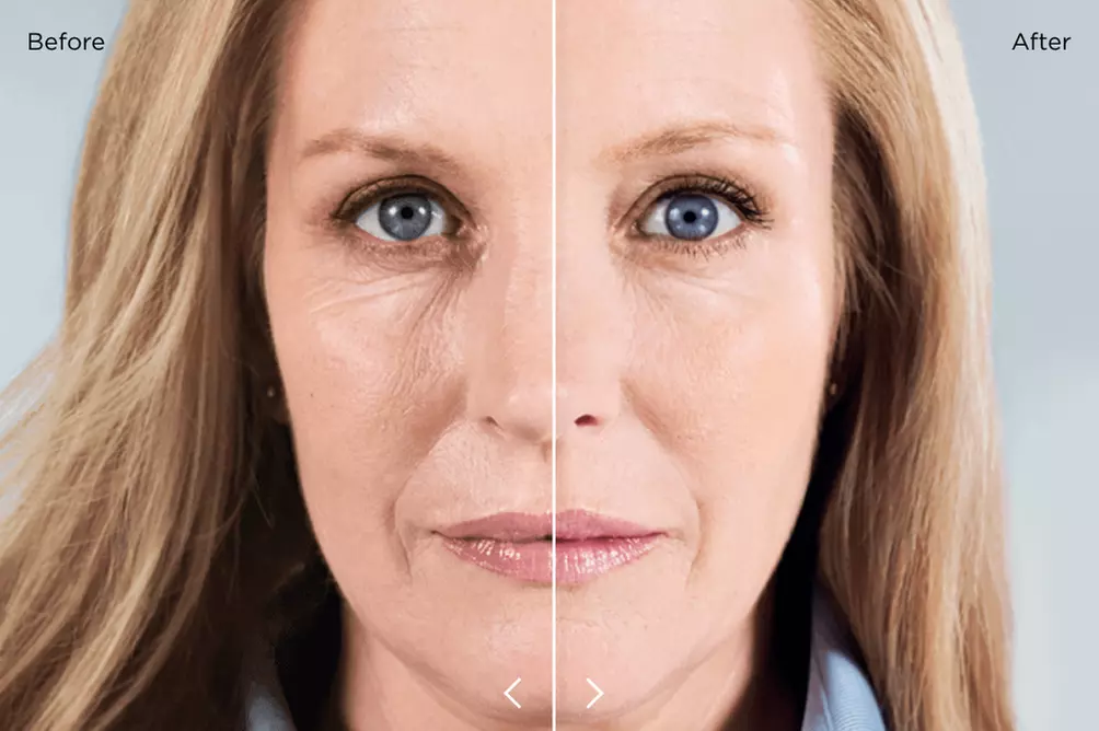 Enhance with Sculptra for Face or Vials for Hip & Butt
