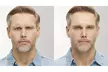 20 Units of Botox at BodyBrite Austin – Quick, Effective Results and Minimal Downtime - Up to 40%% Off - Second Medium