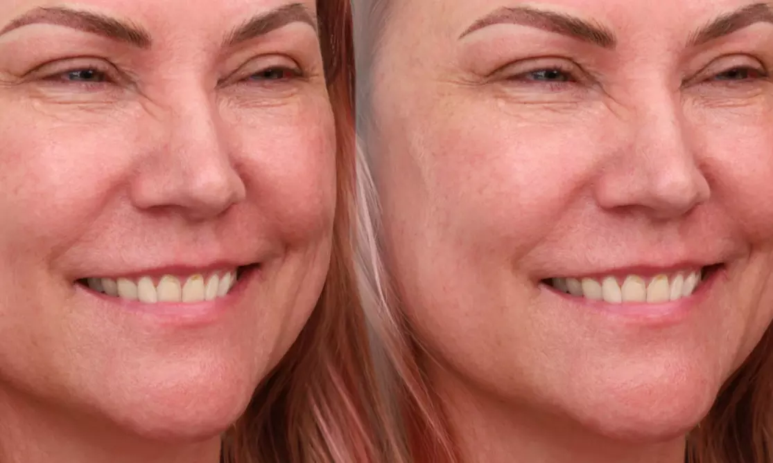 Up to 30% Off on Permanent Makeup at Mia Brows Lashes