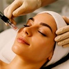 Image 1: Relax with One or Two Microneedling Sessions with LED Light Therapy